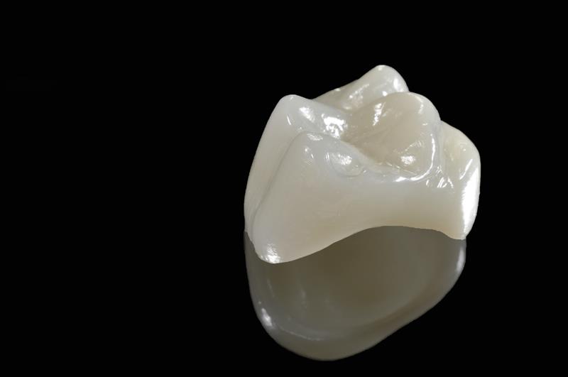 Porcelain Crowns Crescent City, CA